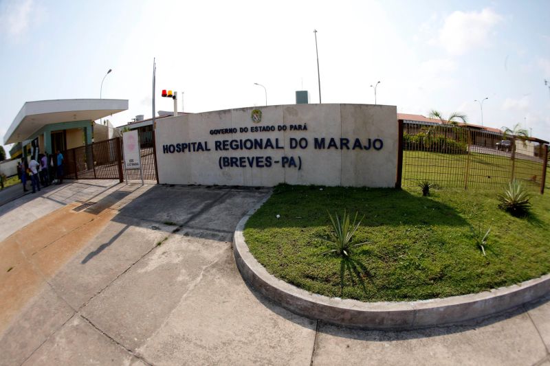 notícia: Vítimas de escalpelamento recebem atendimento no Hospital Regional em Breves