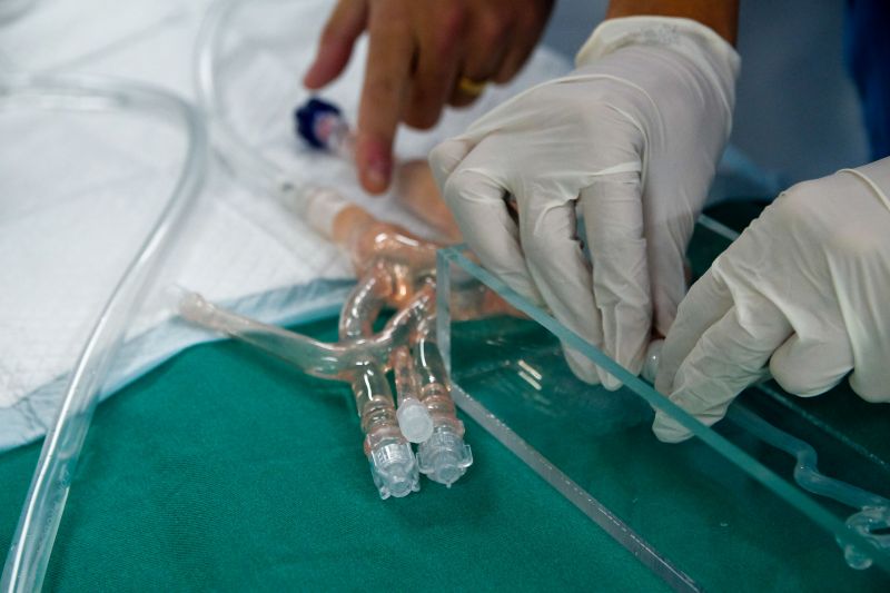 Hospital Abelardo Santo realiza cirurgia de alta complexidade para remover aneurisma cerebral em paciente.
 <div class='credito_fotos'>Foto: Pedro Guerreiro / Ag. Pará   |   <a href='/midias/2021/originais/8612_e04db87f-d250-5f69-7770-92f55a72e4d8.jpg' download><i class='fa-solid fa-download'></i> Download</a></div>