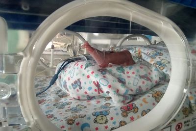 notícia: Santa Casa é referência no atendimento humanizado ao recém-nascido prematuro