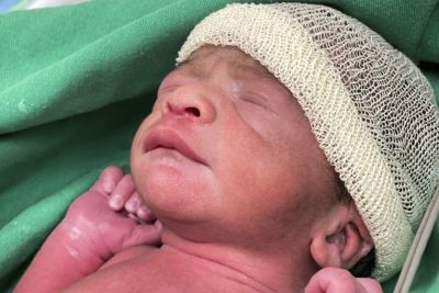 notícia: Trigêmeos nascem no Hospital do Sudeste do Pará Dr. Geraldo Veloso (HRSP), em Marabá