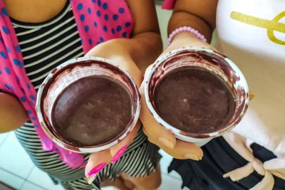 notícia: Santa Casa do Pará inova ao incluir açaí na alimentação de vítimas de escalpelamento atendidas 