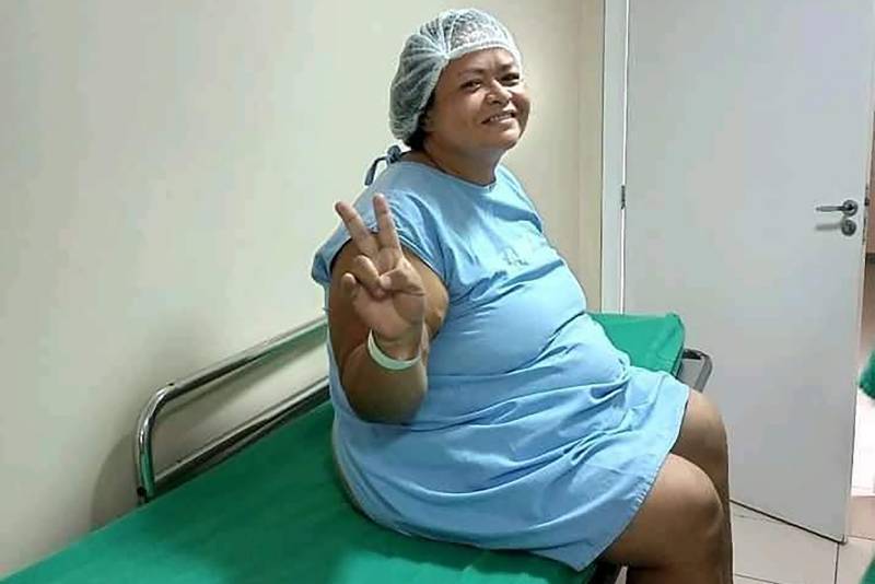 paciente Lussandra Silva antres da cirurgia