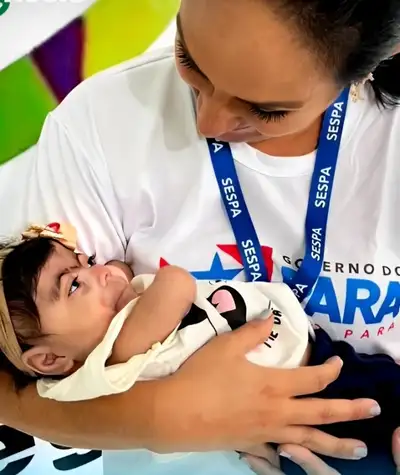 notícia: Pará é referência nacional no atendimento a pacientes com fissuras labiopalatais