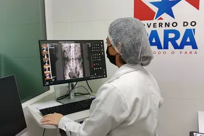 notícia: Hospital Regional de Oriximiná realiza mais de 2.600 exames de raio X em 2025