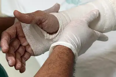 notícia: Hospital do Marajó amplia assistência para traumas com Porta Aberta e Telemedicina 