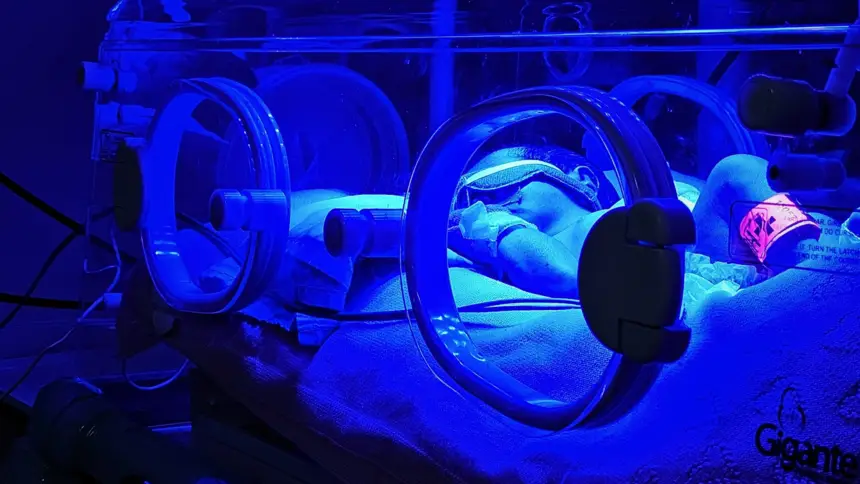 UTI Neonatal do HRAS une tecnologia e humanização na recuperação de recém-nascidos de alto risco