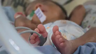 notícia: Hospital Abelardo Santos reforça importância do Teste do Pezinho à prevenção de doenças