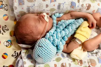 notícia: Hospital Geral de Tailândia adota polvos terapêuticos para recém-nascidos da UTI Neonatal 