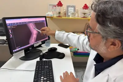 notícia: Hospital Oncológico Infantil Octávio Lobo destaca a importância do diagnóstico precoce no combate a tumores ósseos